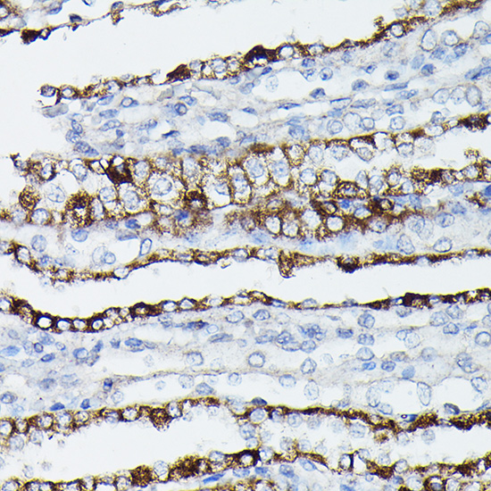 Anti-AQP3 Antibody (CAB2838)