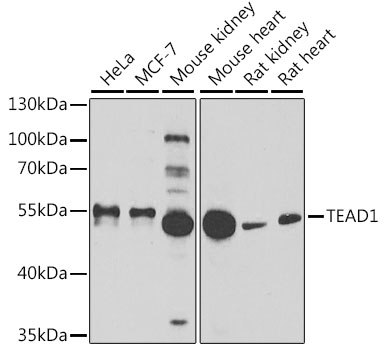 Anti-TEAD1 Antibody (CAB6768)