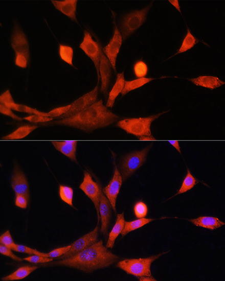 Anti-ADK Antibody (CAB15023)