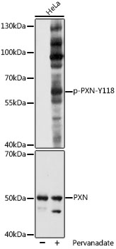 Anti-Phospho-PXN-Y118 Antibody (CABP1057)