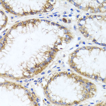 Anti-GPM6A Polyclonal Antibody (CAB9066)