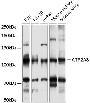 Anti-ATP2A3 Antibody (CAB14232)