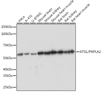 Anti-ATGL/PNPLA2 Antibody (CAB5126)