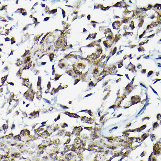 Anti-Smad2 Antibody (CAB11498)