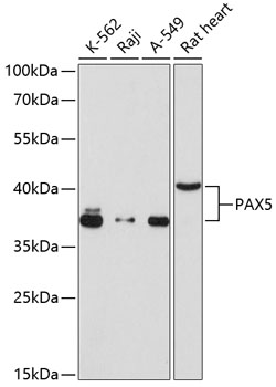 Anti-PAX5 Antibody (CAB12048)