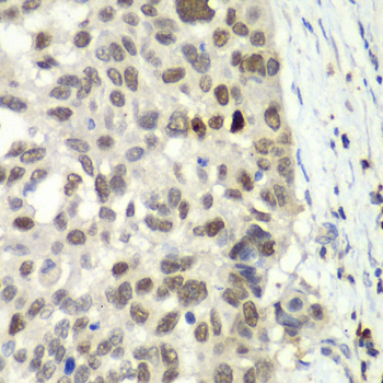 Anti-E2F6 Antibody (CAB2718)