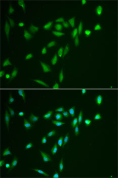 Anti-SRPK1 Antibody (CAB12510)