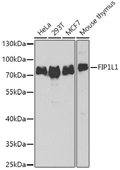 Anti-FIP1L1 Antibody (CAB7138)