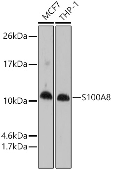 Anti-S100A8 Antibody (CAB1688)