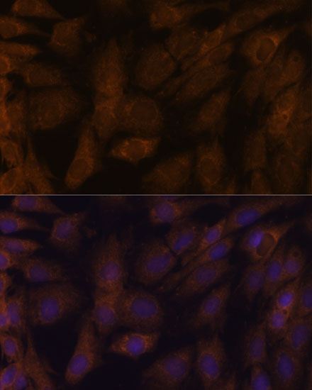 Anti-TXNRD1 Antibody (CAB16631)