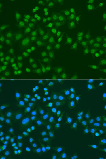 Anti-MSI1 Antibody (CAB2609)