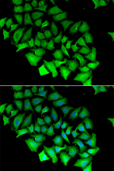 Anti-ACY1 Antibody (CAB6351)