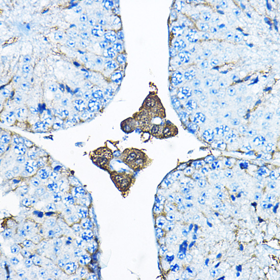 Anti-IDS Antibody (CAB1857)