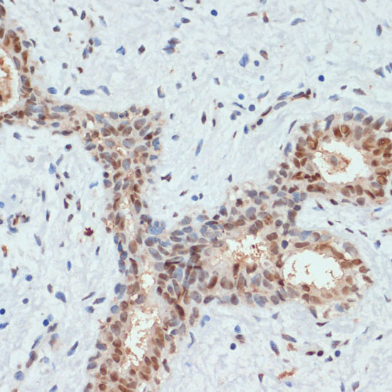 Anti-Phospho-AKT1-S473 Antibody (CABP0140)