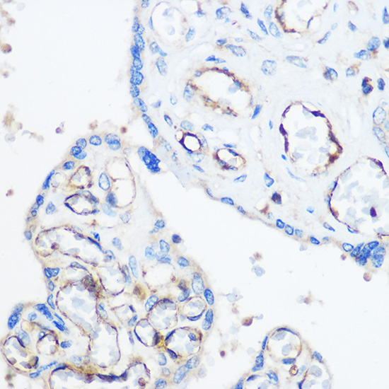 Anti-CD31/PECAM1 Antibody (CAB2104)