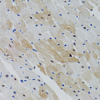 Anti-PTPN11 Antibody (CAB2793)