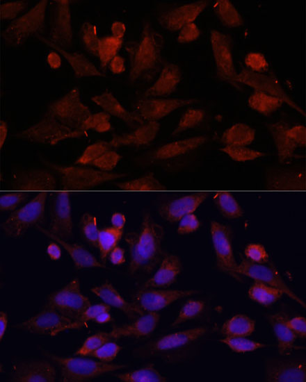 Anti-GPER1 Antibody (CAB10217)