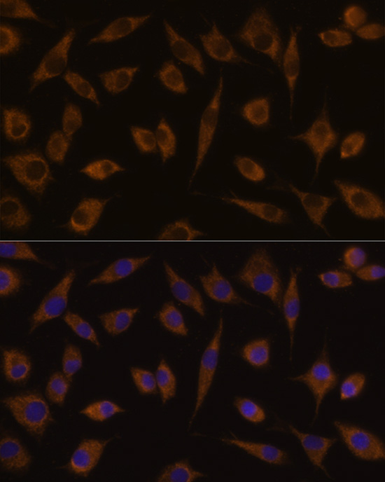 Anti-UGT1A1 Antibody (CAB1359)