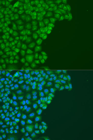 Anti-DAPK2 Polyclonal Antibody (CAB8199)