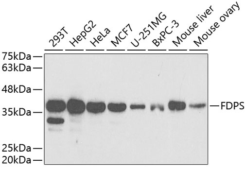 Anti-FDPS Antibody (CAB5744)