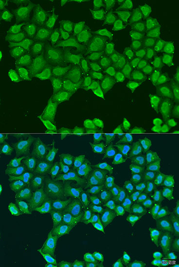 Anti-ATP5O Polyclonal Antibody (CAB8103)