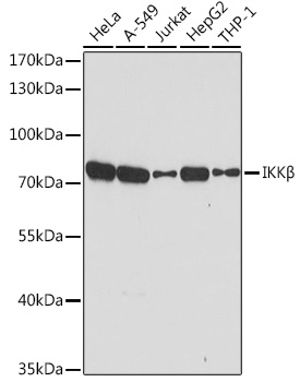 Anti-IKKBeta Antibody (CAB2087)