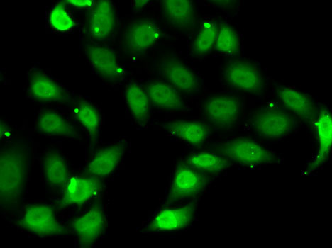 Anti-TEAD1 Antibody (CAB6768)