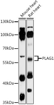 Western blot analysis of extracts of various cell lines, using PLAG1 antibody at 1:1000 dilution. Secondary antibody: HRP Goat Anti-Rabbit IgG (H+L) at 1:10000 dilution. Lysates/proteins: 25ug per lane. Blocking buffer: 3% nonfat dry milk in TBST. Detection: ECL Basic Kit. Exposure time: 90s.