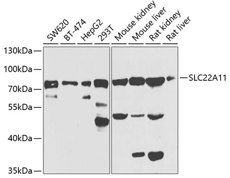 Anti-SLC22A11 Antibody (CAB7816)