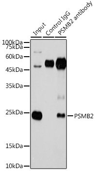 Anti-PSMB2 Antibody (CAB5483)