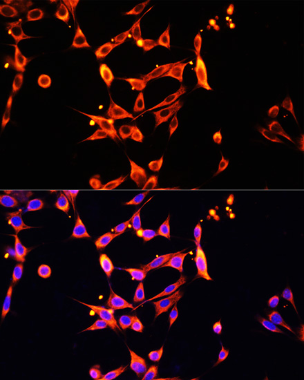 Anti-Heparanase 1 Antibody (CAB16488)