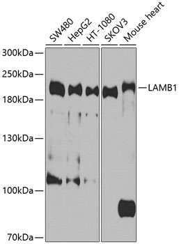 Anti-LAMB1 Polyclonal Antibody (CAB9827)