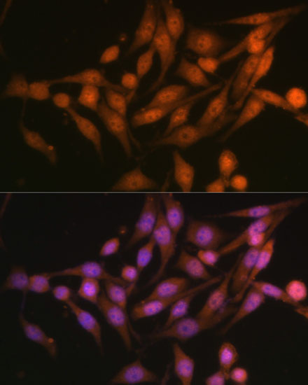 Anti-PSMD13 Antibody (CAB6956)