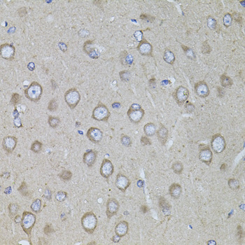 Anti-CRHR1 Polyclonal Antibody (CAB8409)