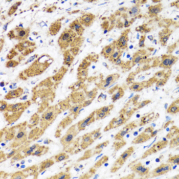 Anti-HAPLN1 Antibody (CAB6616)