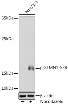 Anti-Phospho-Stathmin-S38 Antibody (CABP0221)