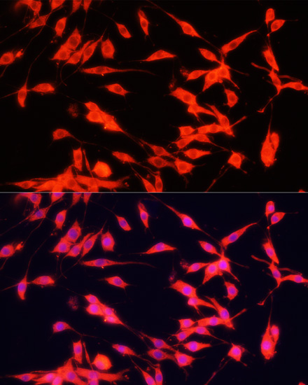 Anti-FXR1 Antibody (CAB16447)