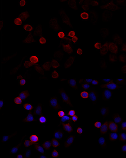 Anti-FLNC Antibody (CAB13018)