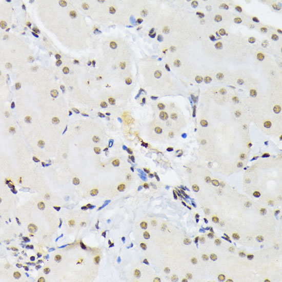 Anti-PTBP1 Antibody (CAB1831)