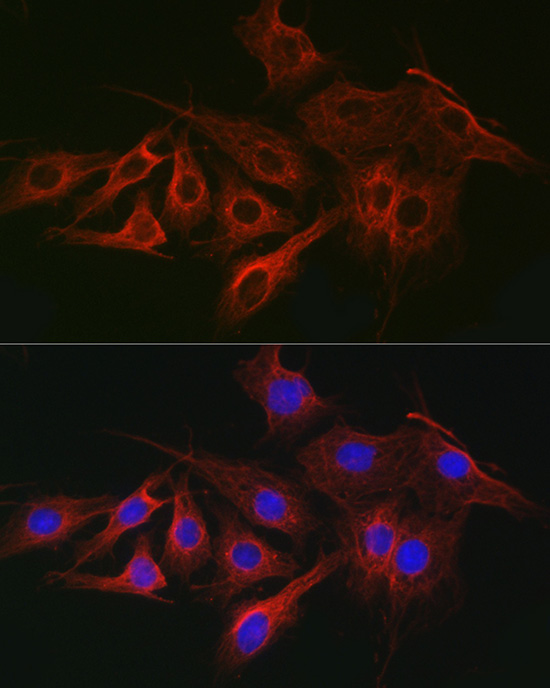 Anti-Alpha-Tubulin Mouse Monoclonal Antibody (CABC012)