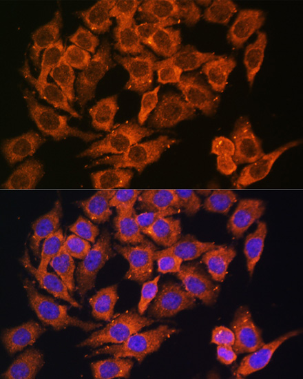 Anti-MYO6 Antibody (CAB13033)