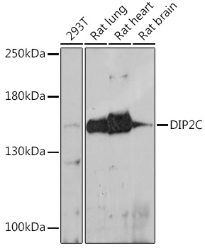 Anti-DIP2C Antibody (CAB18352)