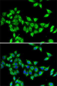 Anti-KIF3A Antibody (CAB6639)