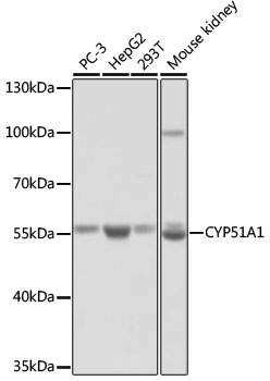 Anti-CYP51A1 Antibody (CAB13485)