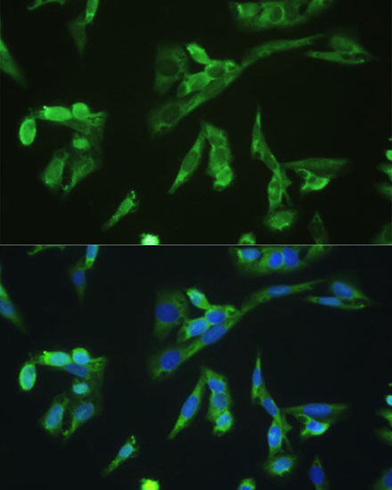 Anti-PD-1 Antibody (CAB11973)