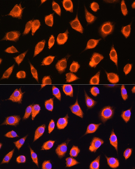 Anti-LMBRD1 Antibody (CAB15866)