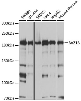 Anti-BAZ1B Polyclonal Antibody [KO Validated] (CAB9851)