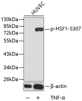 Anti-Phospho-HSF1-S307 Antibody (CABP0364)