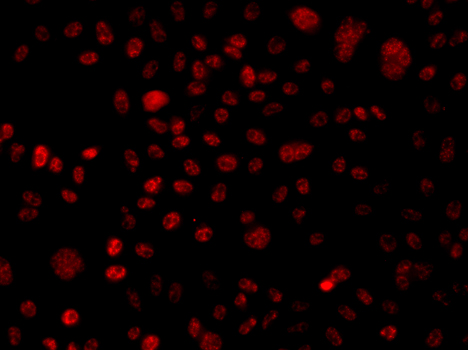 Anti-BAF250 Antibody (CAB7607)