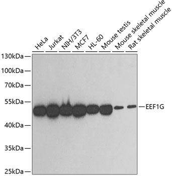 Anti-EEF1G Antibody (CAB2721)